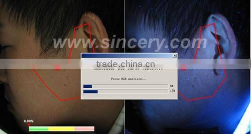 Facial Reveal Skin And Hair Analysis Machine for Skin Testing