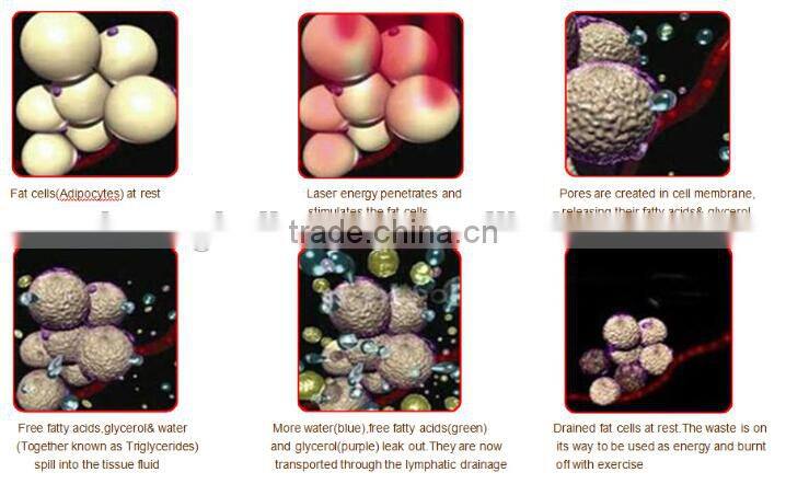 protable lipo laser machine fat removal slim laser liposuction machine for sale