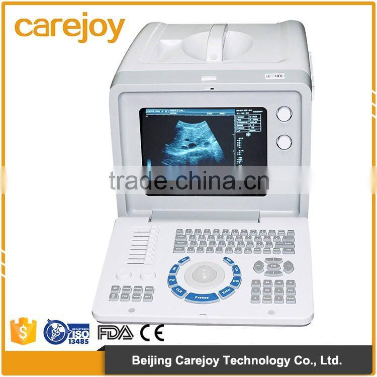 RUS-9000F2 CE&ISO easy carrying portable ultrasound scanner price