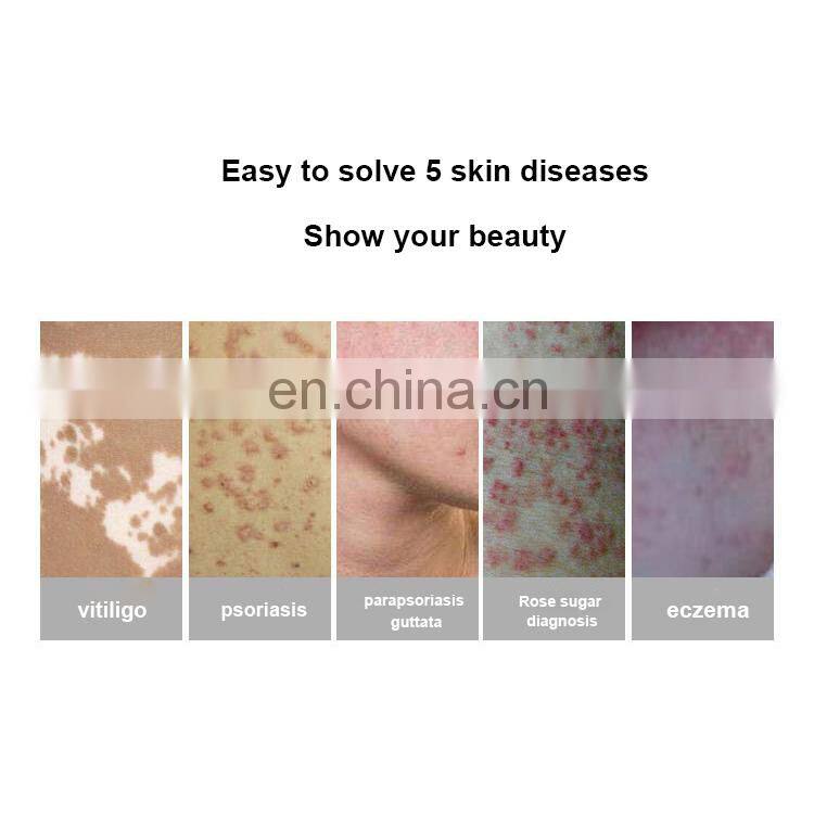 Sales Best effect vitiligo treatment machine UV lamp Phototherapy Radiation vitiligo treatment machine for health care