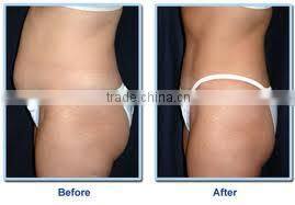 New designed skin tightening vacuum cavitation rf/multipolar vacuum rf