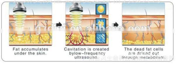 2016 Newest Ultrasonic Body Shaping Liposuction Cavitation Slimming Machine