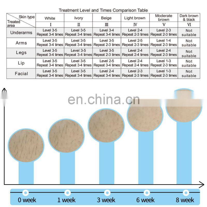 DEESS 300,000 Pulses Flashes Laser Epilator IPL long life home use laser hair removal machine