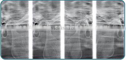 China Cheap Dental Panoramic and Cephalometric X-ray Machine