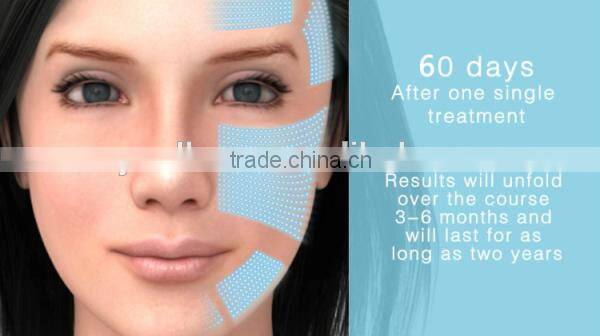 HIFU Facial Beauty Machine for Face lift Brow Lift