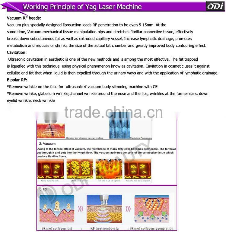 Beauty equipment manufacture 3 in 1 vacuum rf liposuction equipment