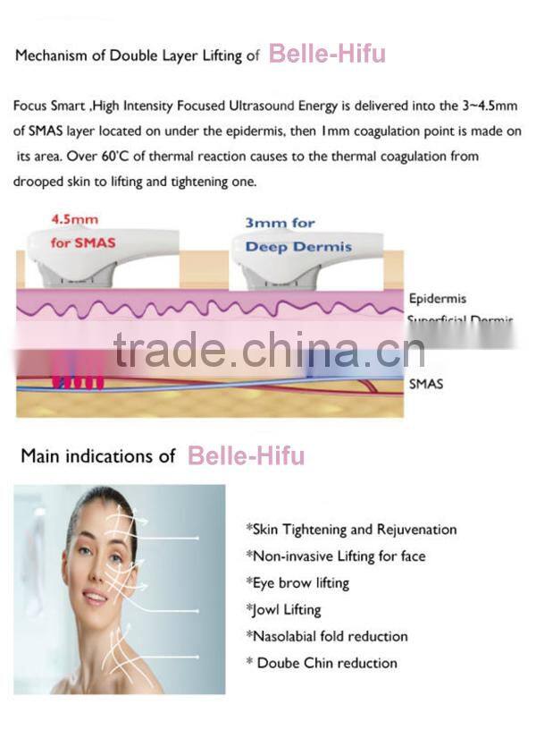 CE Certificated HIFU portable machine/korea/body/face lift Belle-HIFUhifu high intensity focused ultrasound