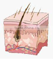 Vertical IPL+ RF hair removal & skin rejuvenation machine MED-130C