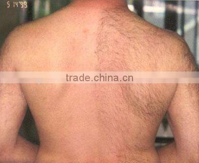 painless hair removal instrument HS 650 ipl shr hair removal machine in motion by shanghai med apolo medical technology