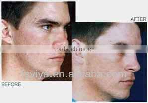 VY-900A auto hot sale diamond dermabrasion machine