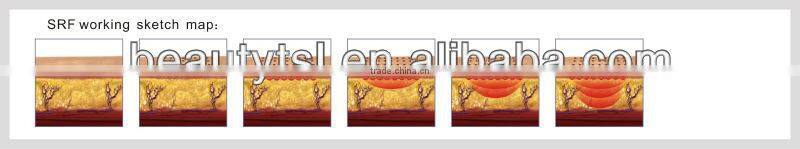 Newest technology newmeir rf fractional micro needle