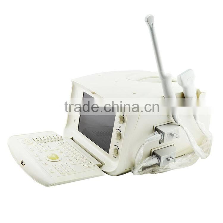 1 USB factory price OEM design 80 elements R60 ultrasound scanner for pregnancy