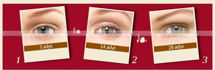 2016 New design electric ultrasonic facial massager with high quality