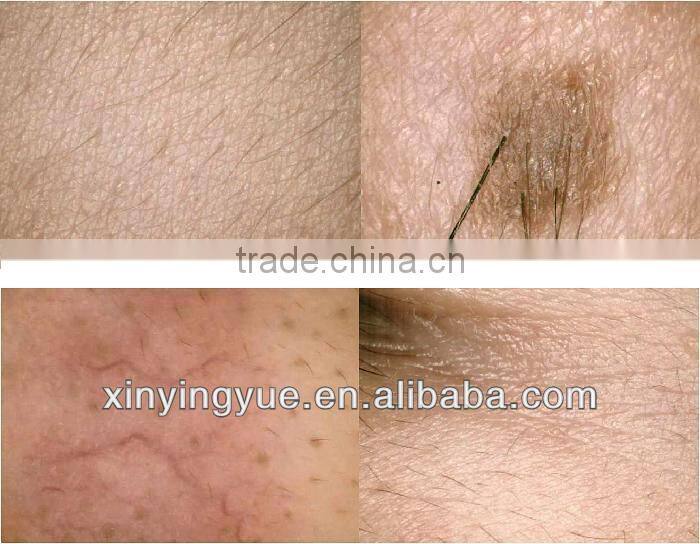 The Newest Professional Hair and skin analyzer