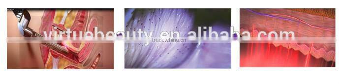 High quality and reliable Laser Gynae machine