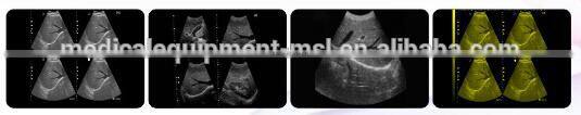 (Pregnant week,fetal weight,volume.etc) Both use in human and animal new portable laptop ultrasound machine/scanner/system price