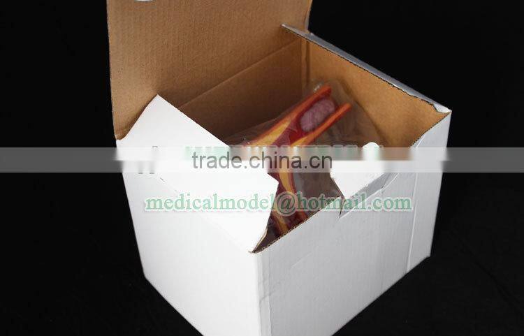 Atherosclearosis and thrombosis model