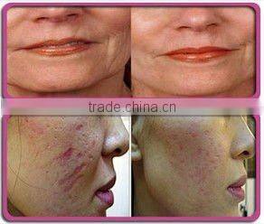 hottest derma roller microneedle dermaroller for skin care collagen injection