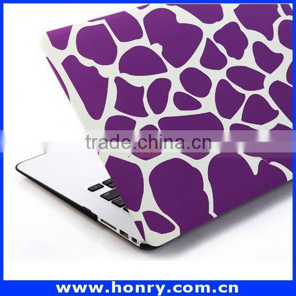 Top level Cheapest hard cover case for macbook air 11