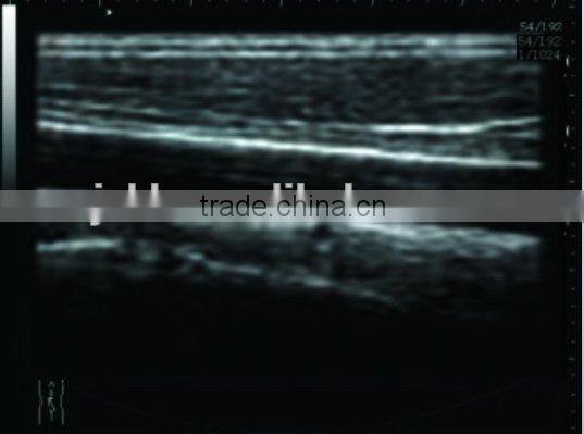 2016 Promotion Medical Portable Laptop Clinic Hospital Ultrasound Scanner Machine with 3.5Mhz Convex Probes--RUS-9000F-Shelly