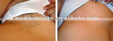 hot in Europe diode laser hair removal distributors wanted for sale