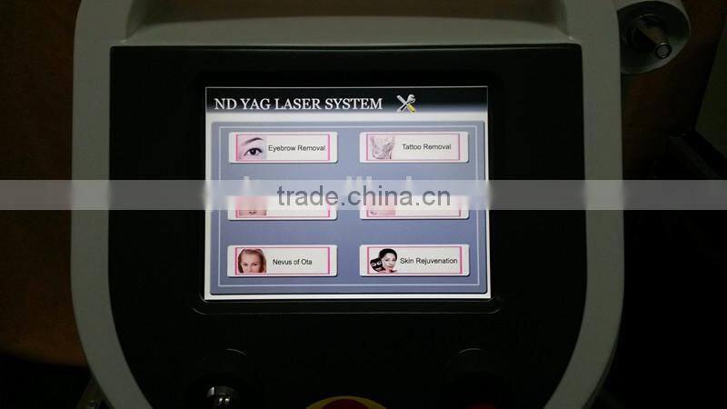 Nd:yag Q-switch pigment arm tattoo removal laser