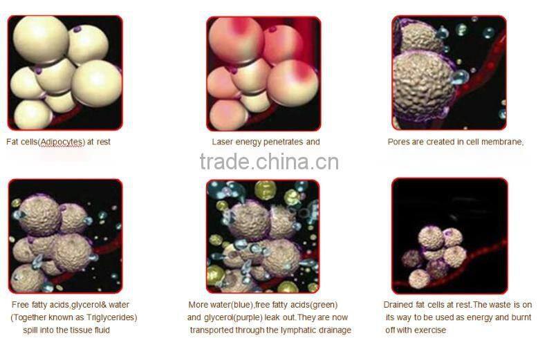 CE Certificated cryotherapy equipment Cavitation & RF & lipo laser Cryolipolysis lipo machine with teaching video