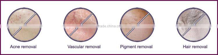 Multifuncational ipl rf two hairy removal with great price