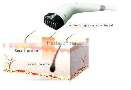 2013 lattest radio frequency skin tightening machine,Rhermage (Perfect skin rejuvenation result after just 1 time treatment!!!!)