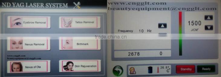 laser tattoo removal victory