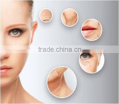 New Designed Bipolar RF Skin Tightening Face Lifting Beauty Equipment Price