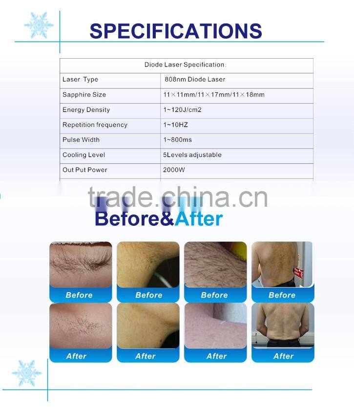 Portable laser diode 808nm diode laser machine