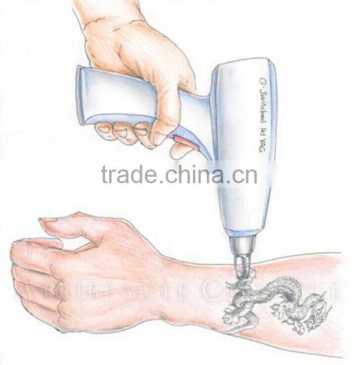 Q switched nd yag laser tattoo removal laser for sale
