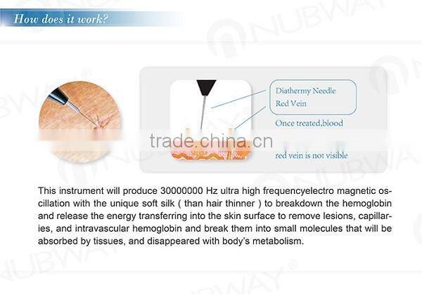 Portable 30Mhz Spider Vein Removal varicose vein treatment Skin Tag Removal Skin Spot Mole Removal Machine