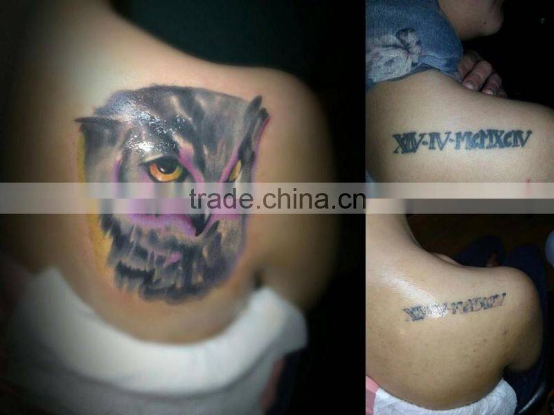 CE Certificated compact hair removal laser 1064nm ndyag tatoo removal beauty machine in alibaba