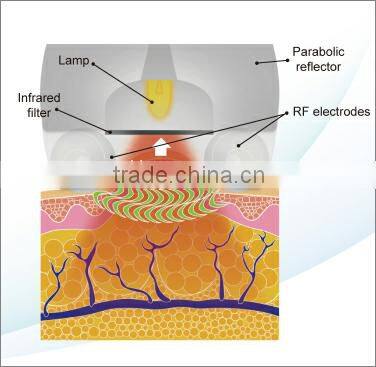 Whole sale weight loss belt for distrubutor