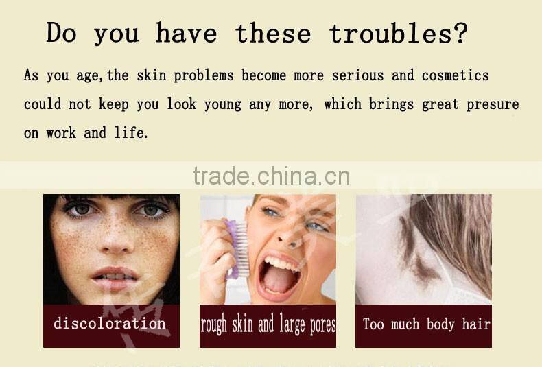 E-light ipl rf+nd yag laser multifunctional machine ipl e-light rf shr