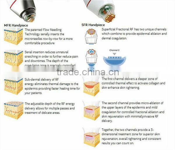 RF fractional microneedle radiofrequency