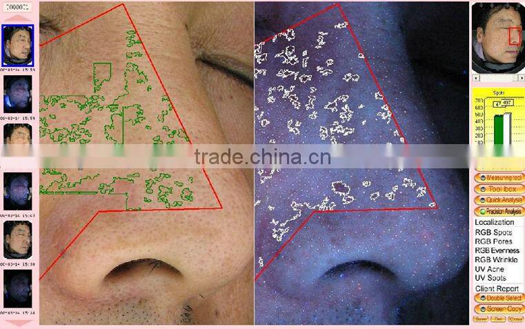 China Best Selling Bauty Machine: high performance mini skin analyzer handheld skin analyzer with CE