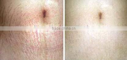 12 needles Mini automatic Microneedle Skin Needling