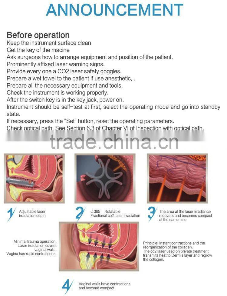 2016 co2 mini laser engraver for beautiful use