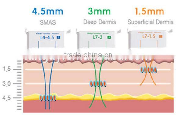 Non-surgical no-wound hifu anti-aging face lift machine with 3 cartridge different treatment