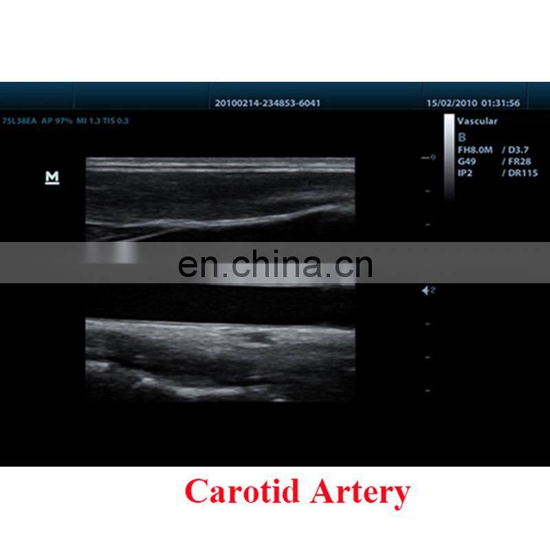 Cheapest Original Mindray DP-50 ultrasound portable ultrasonic diagnosis system/mindary ultrasound