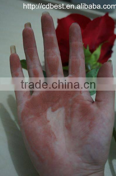 Best05E pure copper ingot for producing electrolytic copper powder