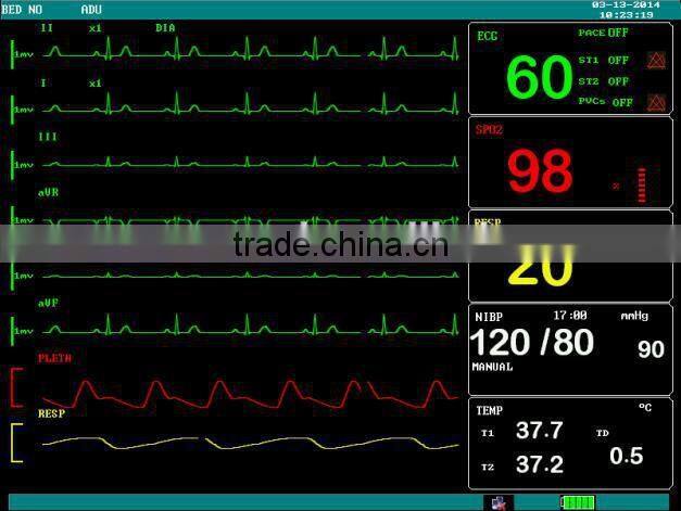 F5 Portable Multi-Parameter Monitor (12.1 inches)