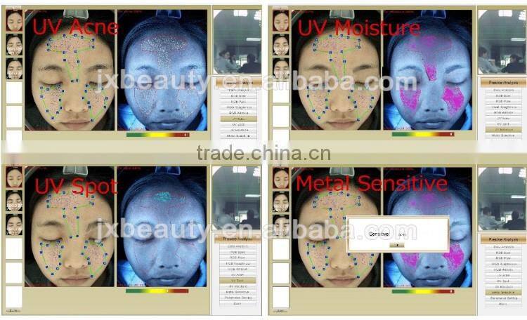 Newest skin health analysis machine/portable hair and skin analyser equipment