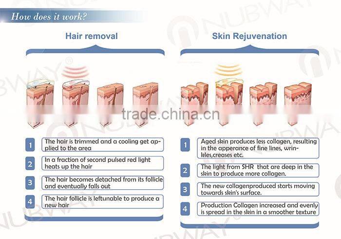 E-light SHR Hair Removal Beauty Device No No Hair Skin Care Product Supply