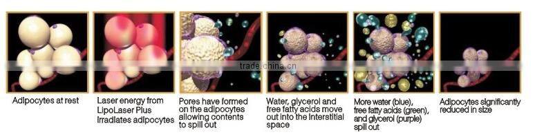 HOT 5 in 1 ultrasonic cavitation rf machine / radio frequency machine