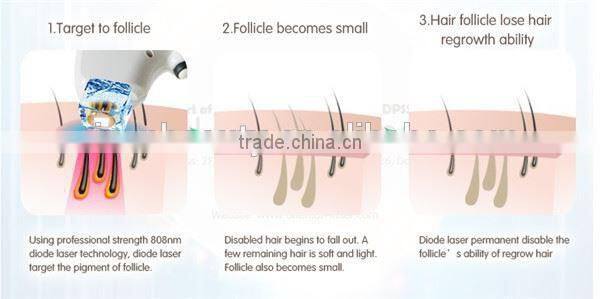 Newest Professional Home and Salon Use 808nm Diode Laser/ Portable 808nm laser Diode/ 808nm Diode Laser Hair Removal