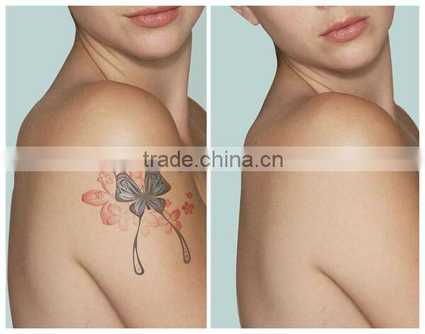 Big discount nd yag laser eye line eyebrow tattoo removal machine D006